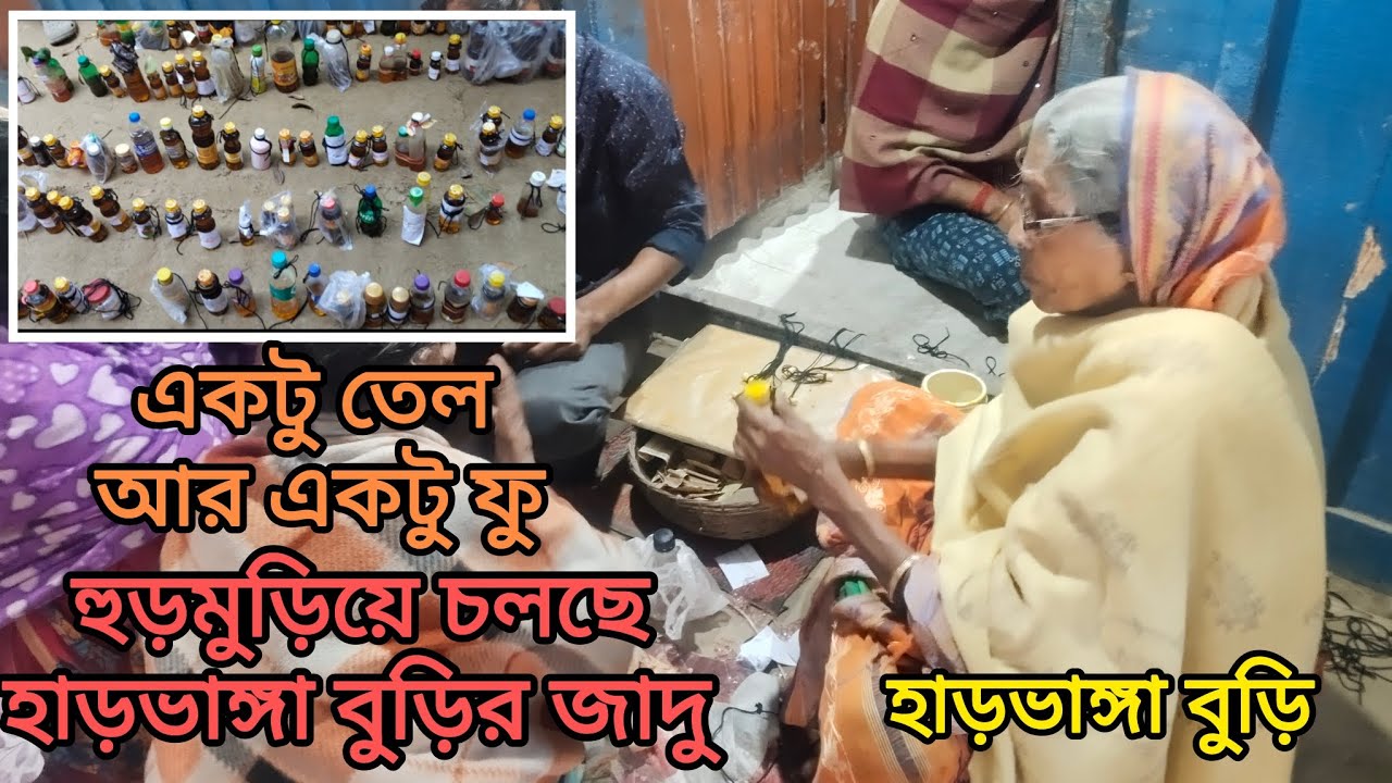 একটু তেলের মধ্যেই এক ফু তেই জাদু||ভাঙ্গা হাড় একবারে জোড়া লেগে যাচ্ছে||maslandapur ||