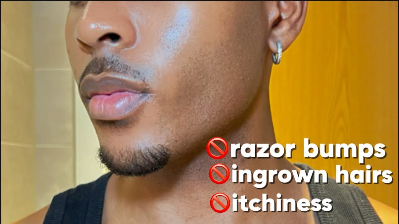 How to get rid of razor bumps & ingrown hairs (Tutorial)