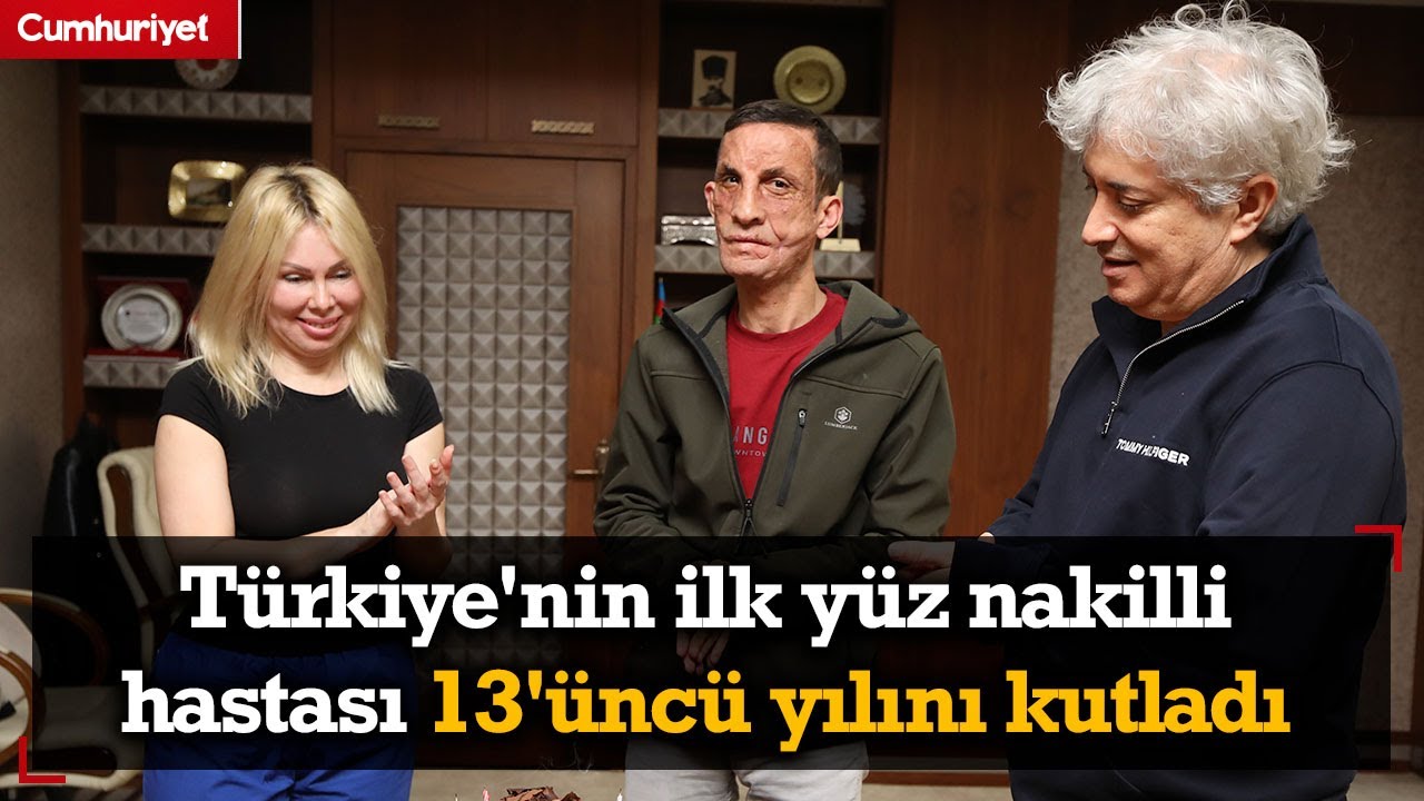Türkiye'nin ilk yüz nakilli hastası Uğur Acar 13'üncü yılını kutladı