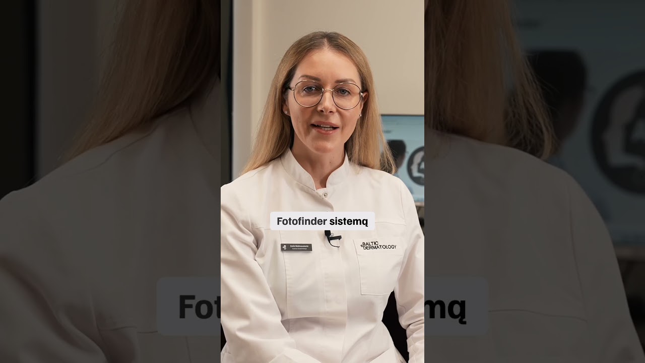 Kaip dirbtinis intelektas tiria apgamus? 🔍🎥#AI #apgamai #apgamas #dermatoskopija