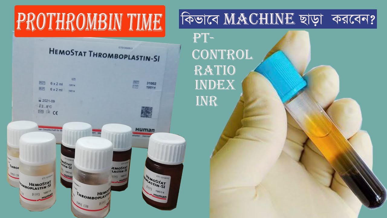 Prothrombin Time Test | PT, INDEX, INR
