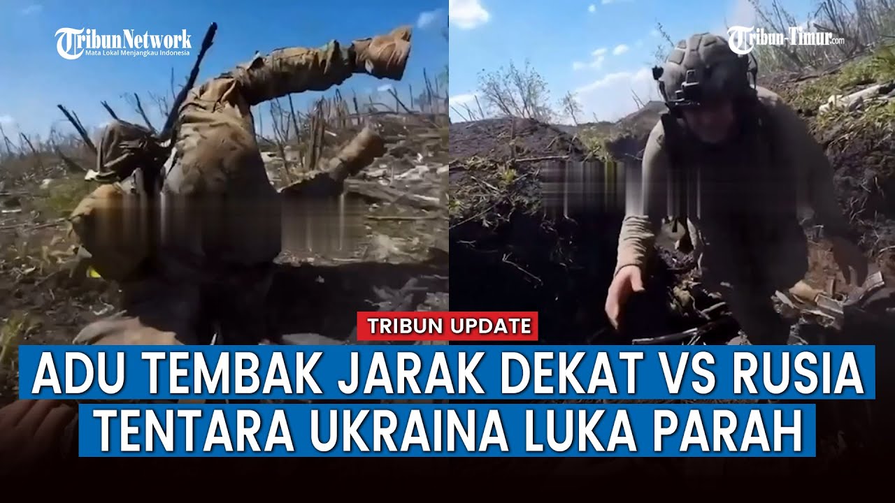 Baku Tembak dengan Rusia, Tentara Ukraina Ini Kena Peluru Prajurit Rusia Hingga Luka Parah