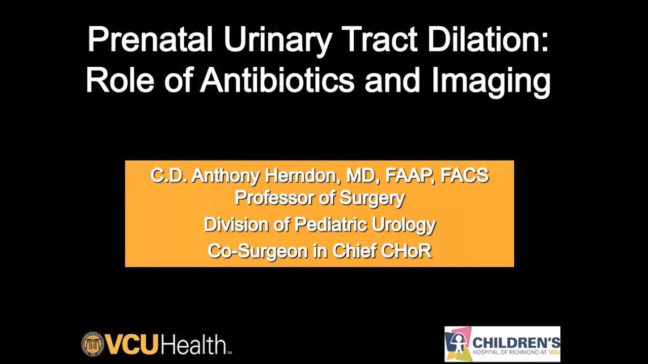 4.17.2020 Urology COViD Didactics - Prenatal Hydronephrosis