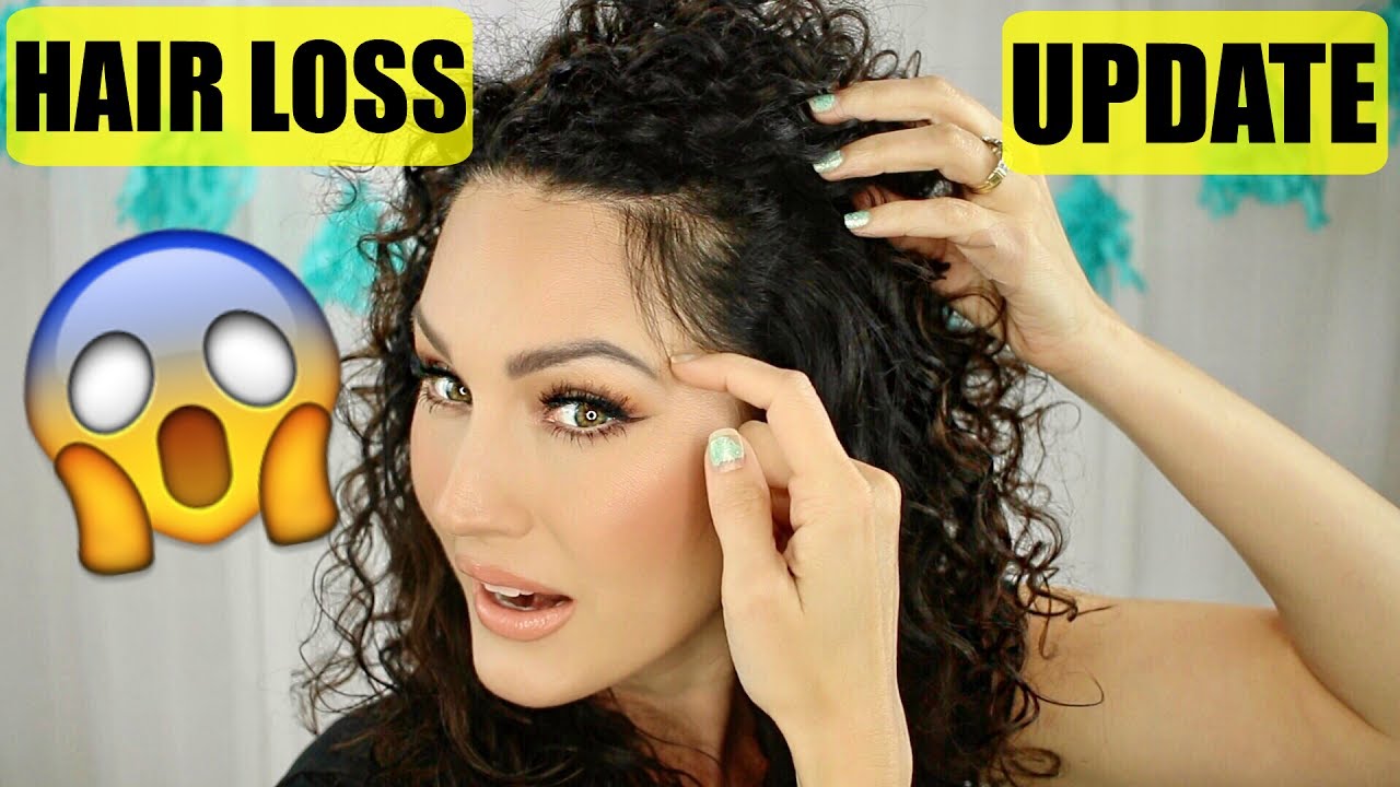 My PCOS Hair Loss UPDATE | The Glam Belle
