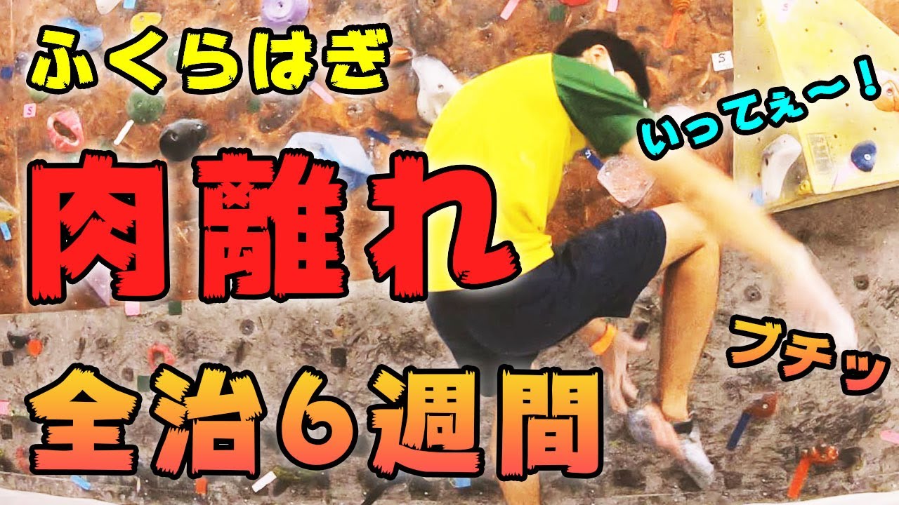ボルダリングで大怪我！ふくらはぎの肉離れで全治6週間！【86回目】