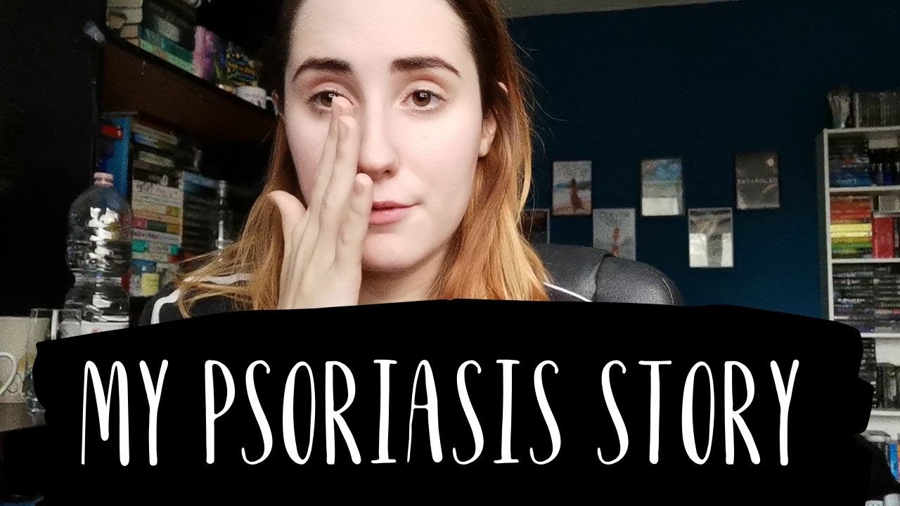 I SHAVED MY HEAD | My Psoriasis Story