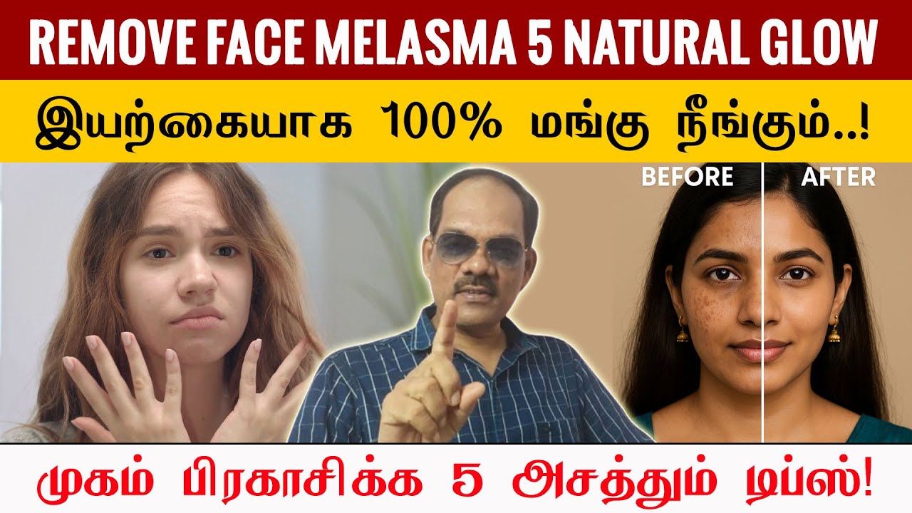 🌿✨ இயற்கையாக மங்கு நீங்கி முகம் பிரகாசிக்க 5 அசத்தும் டிப்ஸ்! | Remove Face MELASMA | சிறப்பு சிவா 🌸
