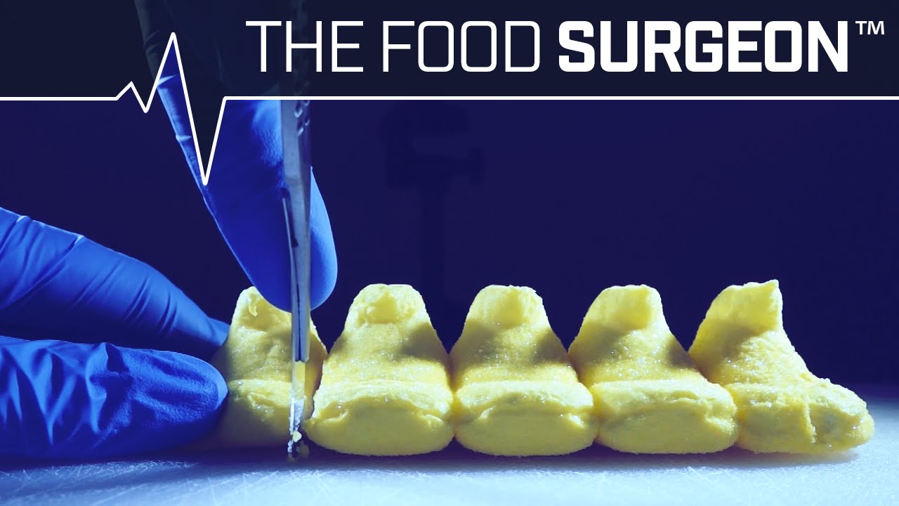Peep Laparotomy with Cadbury Creme Implant