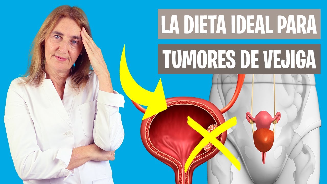 DEBES COMER ESTO con CÁNCER de VEJIGA | Alimentos para tumores en la vejiga | Nutrición clínica