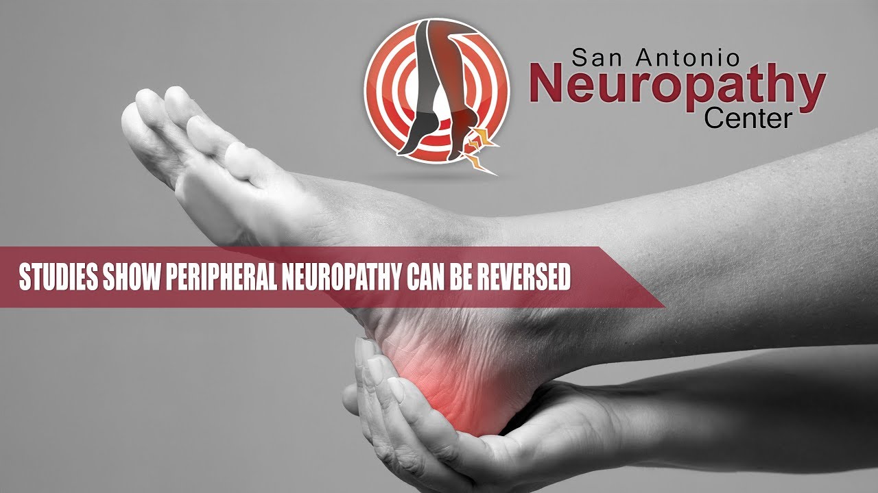 Educational Peripheral Neuropathy Video