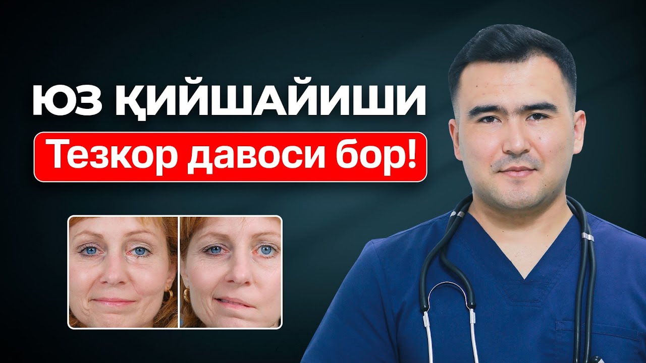 Юз қийшайиши сабаблари ва тезкор давоси | Др Бобур Алимов