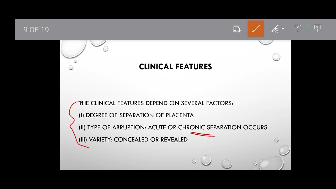 A detailed discussion on Abruptio Placenta 