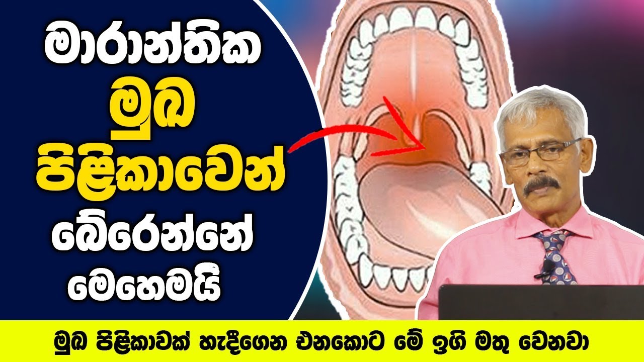 මුඛ පිළිකාවක් හැදීගෙන එනකොට මේ ඉගි මතු වෙනවා - මාරාන්තික මුඛ පිළිකාවෙන් බේරෙන්නේ මෙහෙමයි
