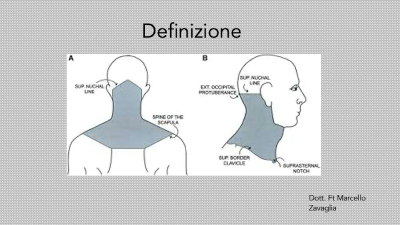 cervicalgia