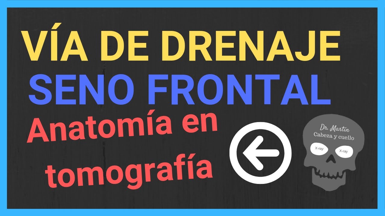 Seno frontal: 💧 DRENAJE (TAC)