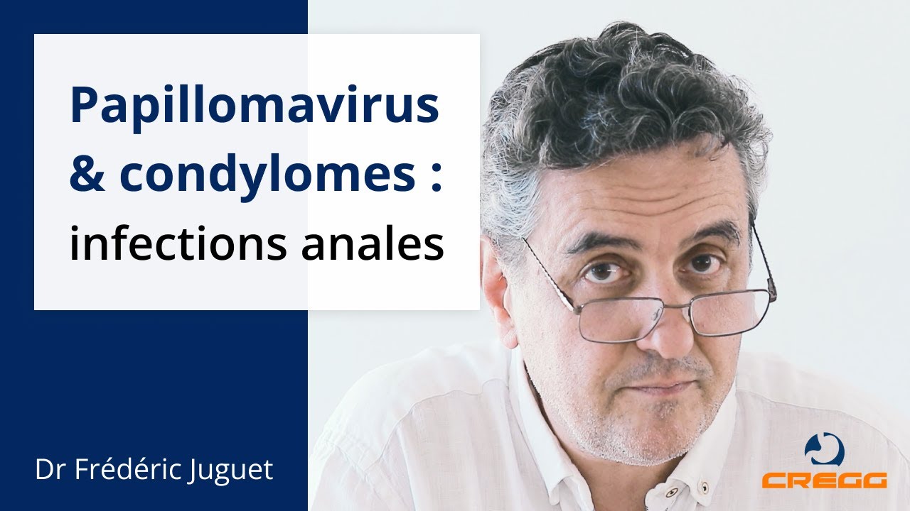 ⏱️ 3 minutes pour comprendre les infections anales &agrave; papillomavirus et les condylomes
