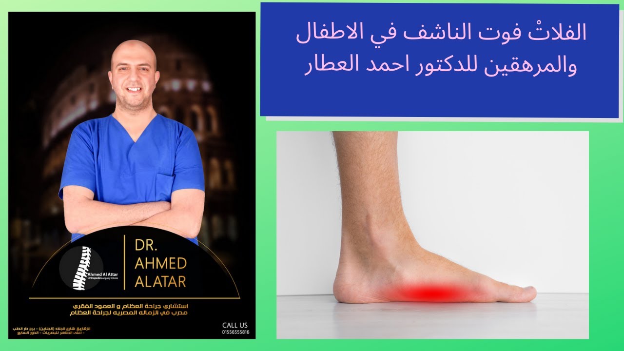 الفلاتْ فوت الناشف في الاطفال والمرهقين