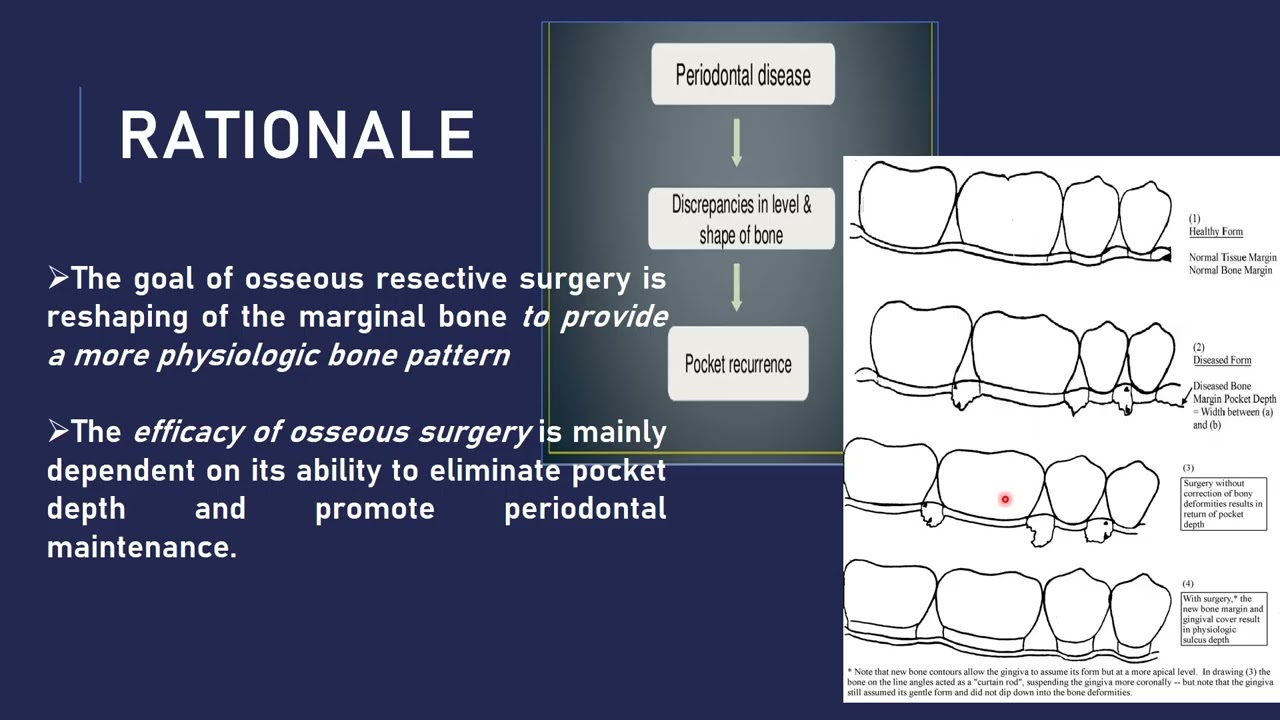 Resective Surgical Techniques