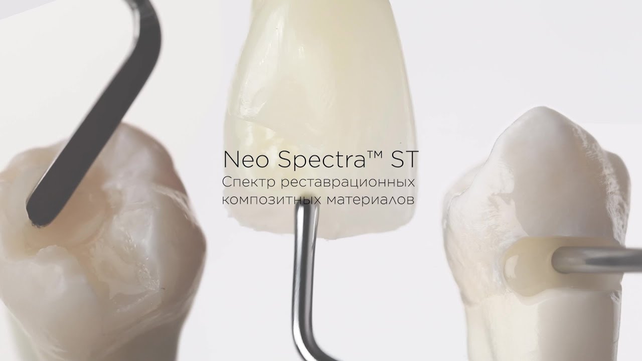 Обзор портфолио Neo Spectra ST