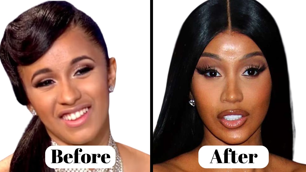 Cardi B&rsquo;s Plastic Surgery Transformation | Before & After