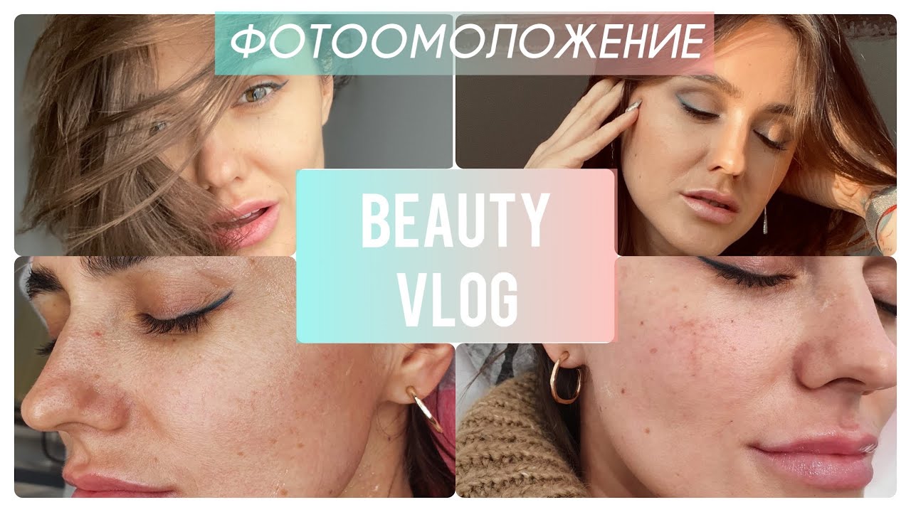 Убираю пигментацию на лице/ Фотоомоложение лица/ beauty vlog. Запорожская Анна