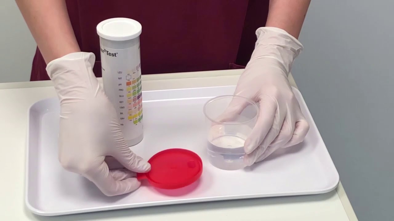 Urinstreifen Test