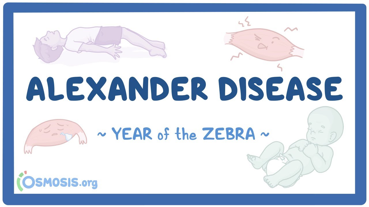 Alexander disease (Year of the Zebra 2025)