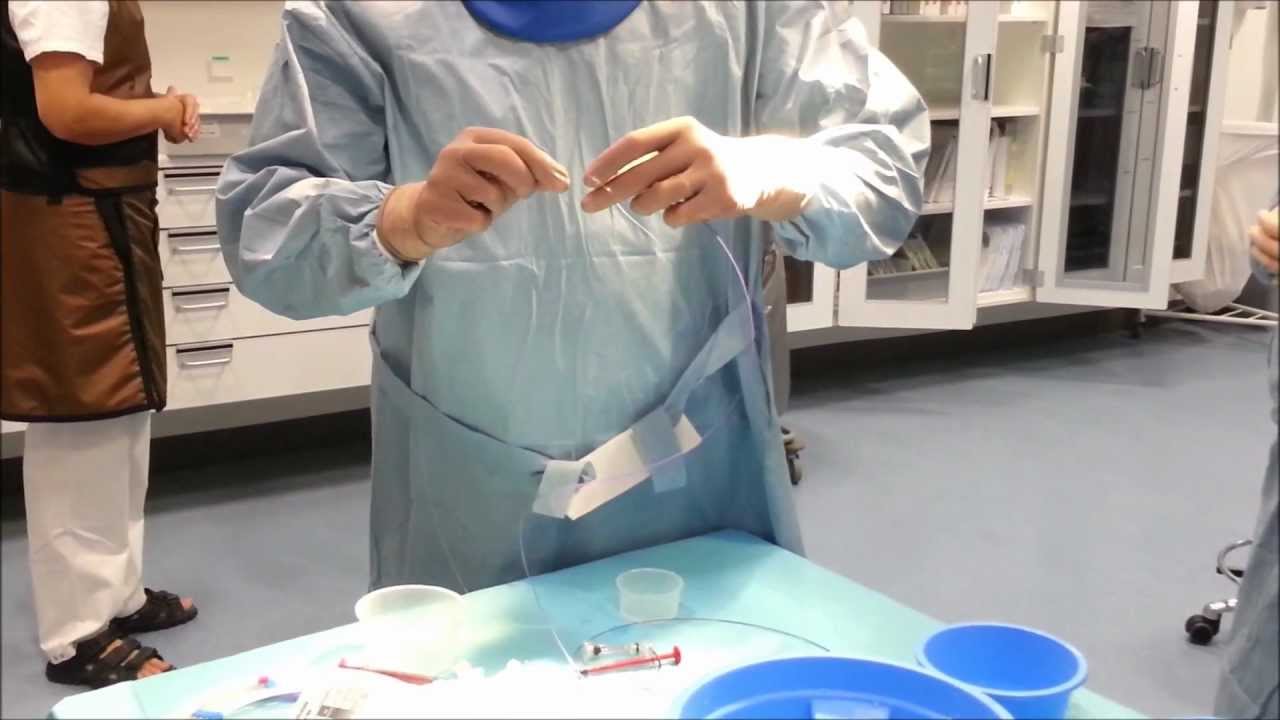 Steps of preparation of Hyperform balloon for assisted aneurysm Coiling