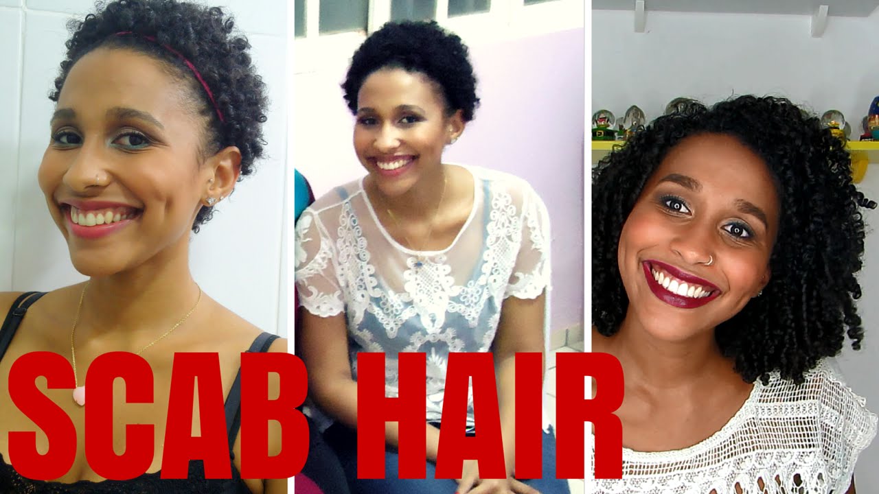 SCAB HAIR: O QUE É? COMO TRATAR?