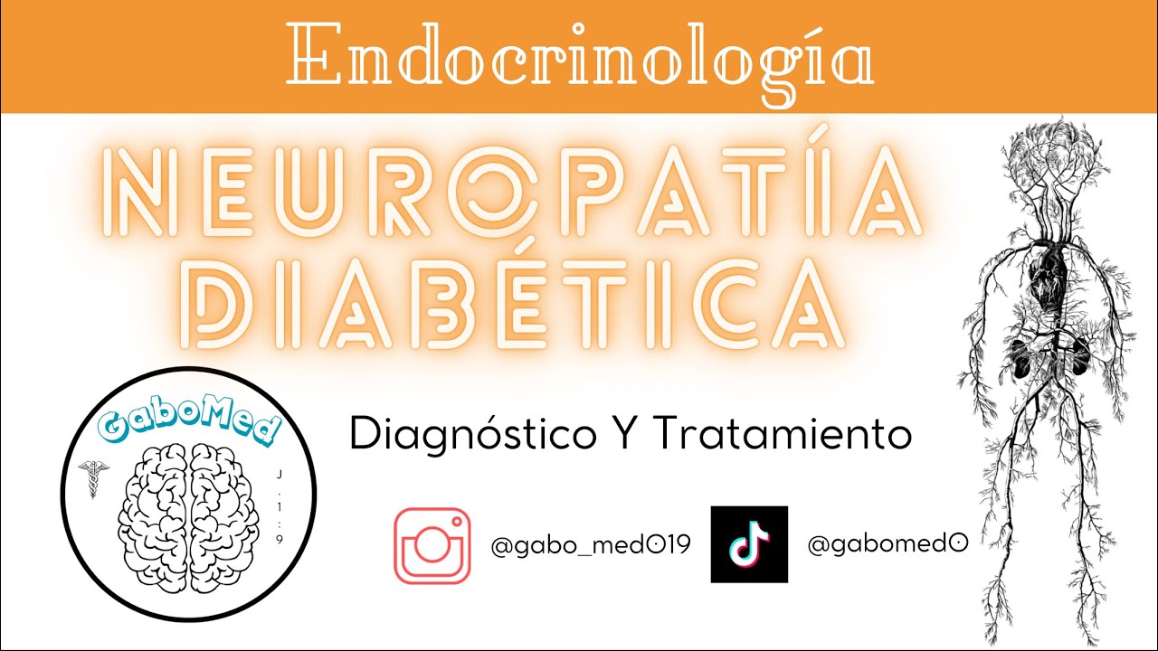 Neuropatía Diabética - Diagnóstico Y Tratamiento
