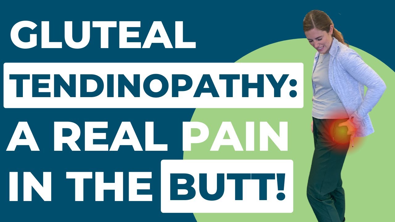 Is Gluteal Tendinopathy a Pain in Your Butt... Literally?