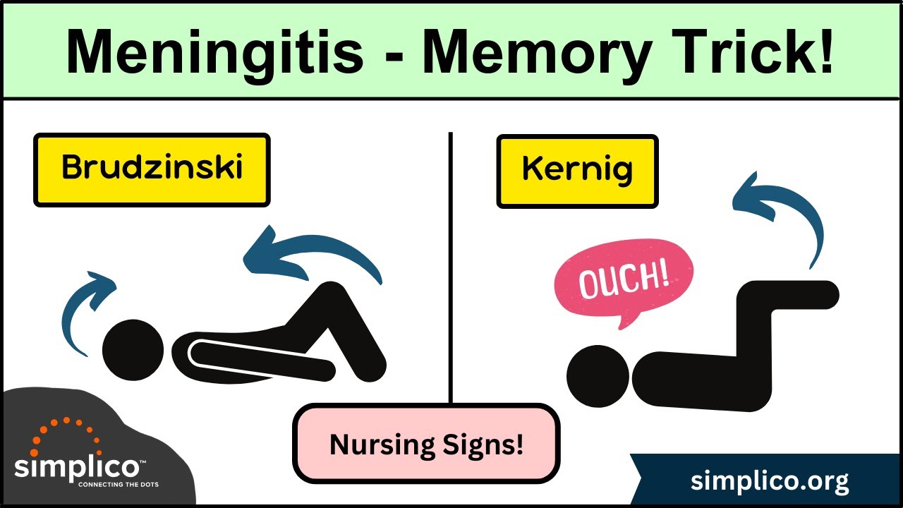 Meningitis | Kernig vs Brudzinski Sign [MEMORY TRICK] #nursing #emt