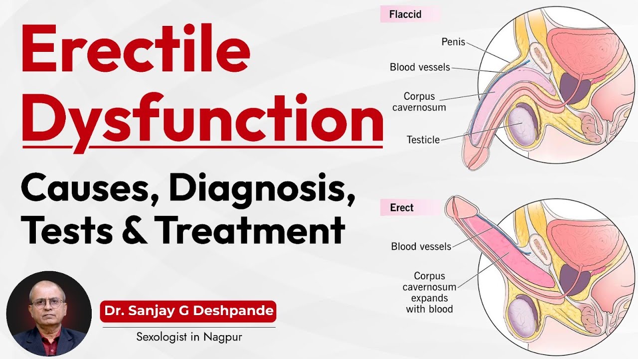 Erectile Dysfunction | Diagnosis | Tests and Medical Treatment | Dr Sanjay Deshpande