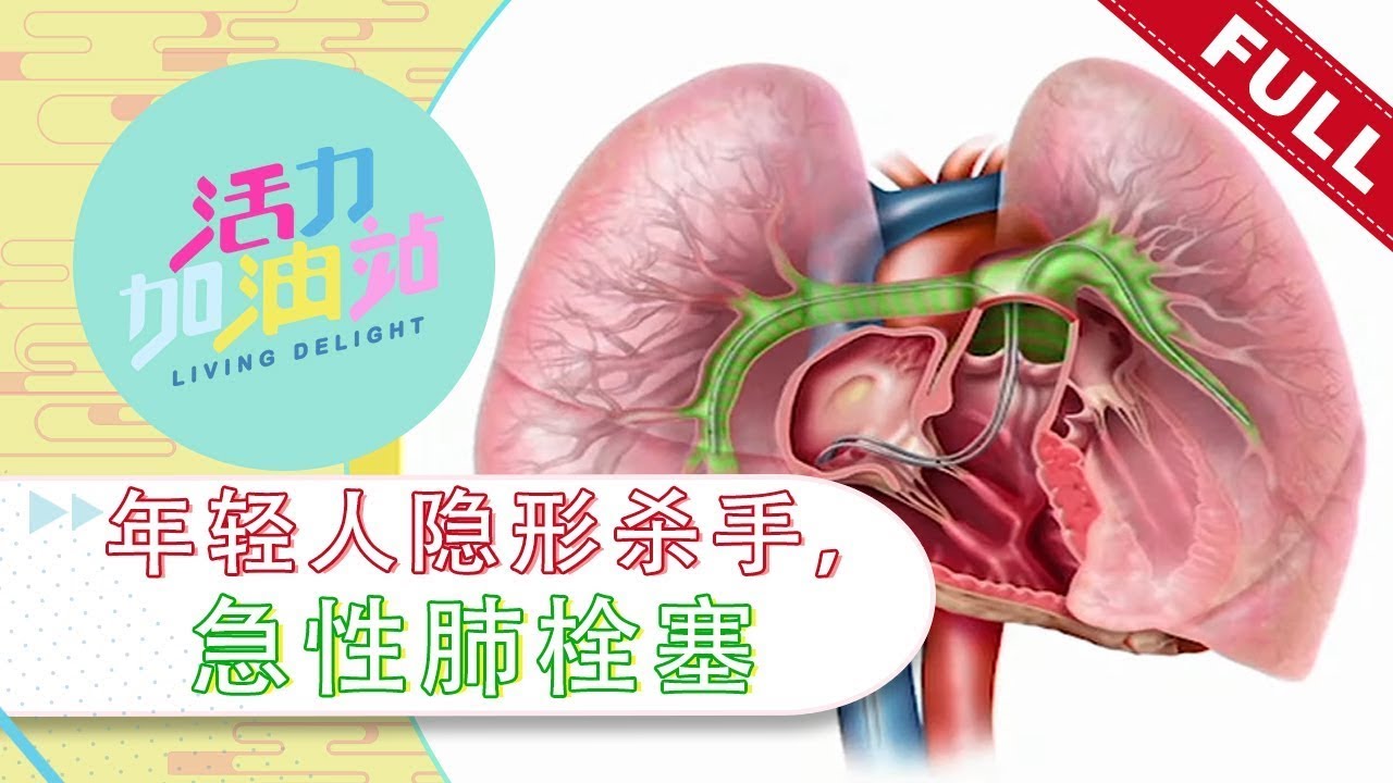 CVSKL: 血管外科陳楷棟医生分享急性肺栓塞和深静脉血栓！