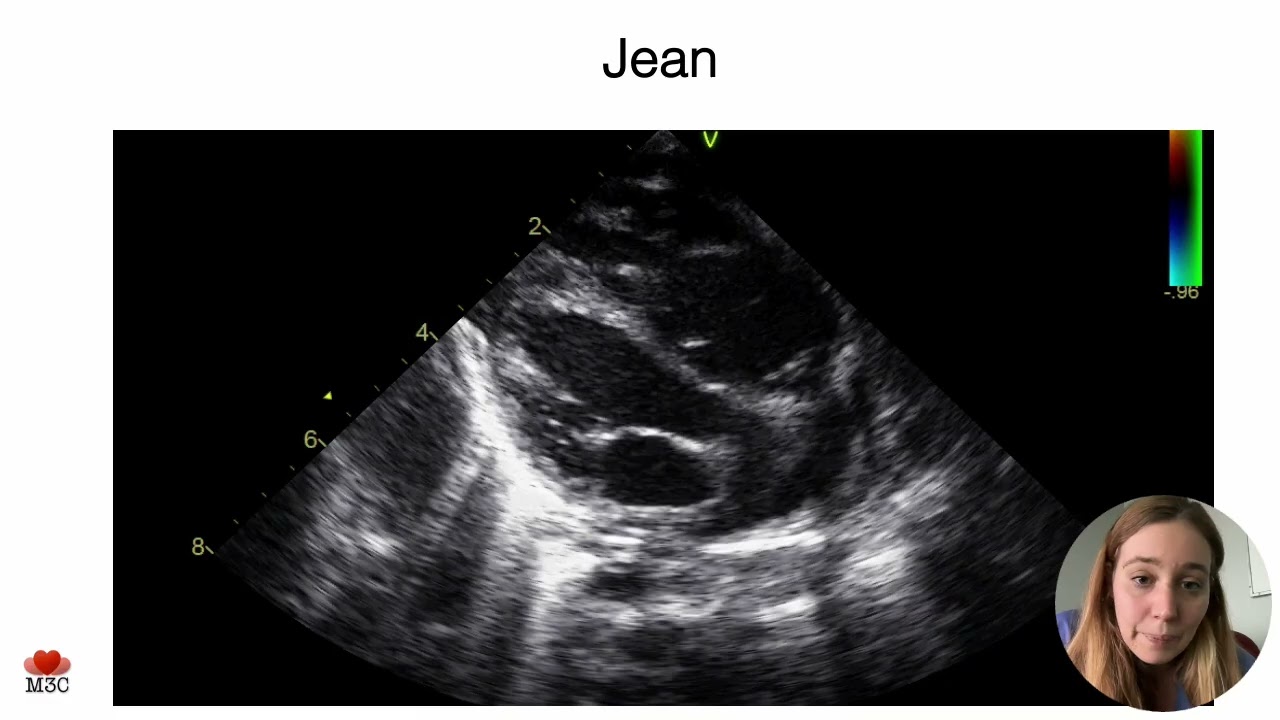 urgences neonatales EP fin 2