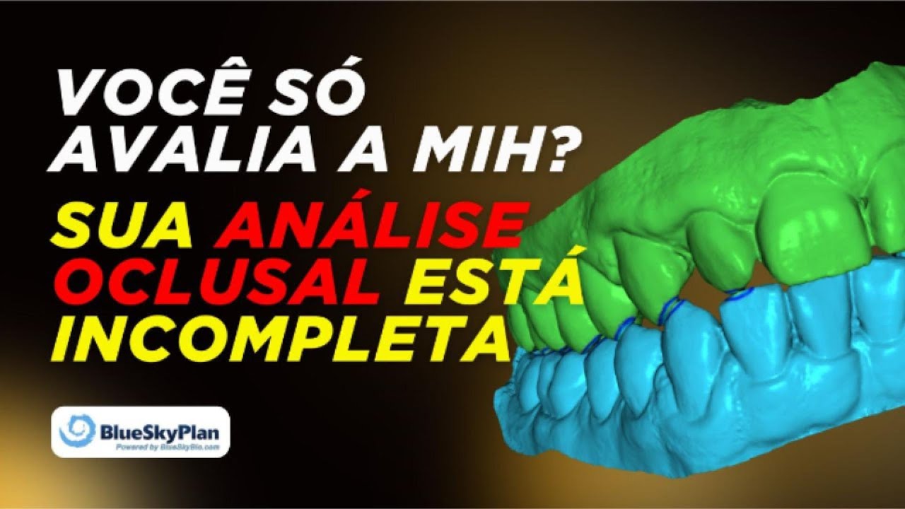 Como identificar todos os toques oclusais em segundos no Blue Sky Plan?