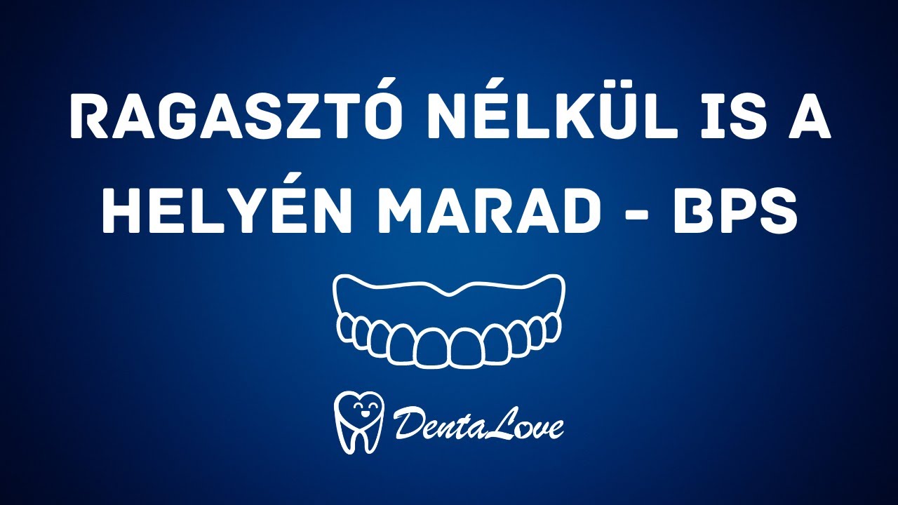 Ragasztó nélkül is a helyén marad - BPS