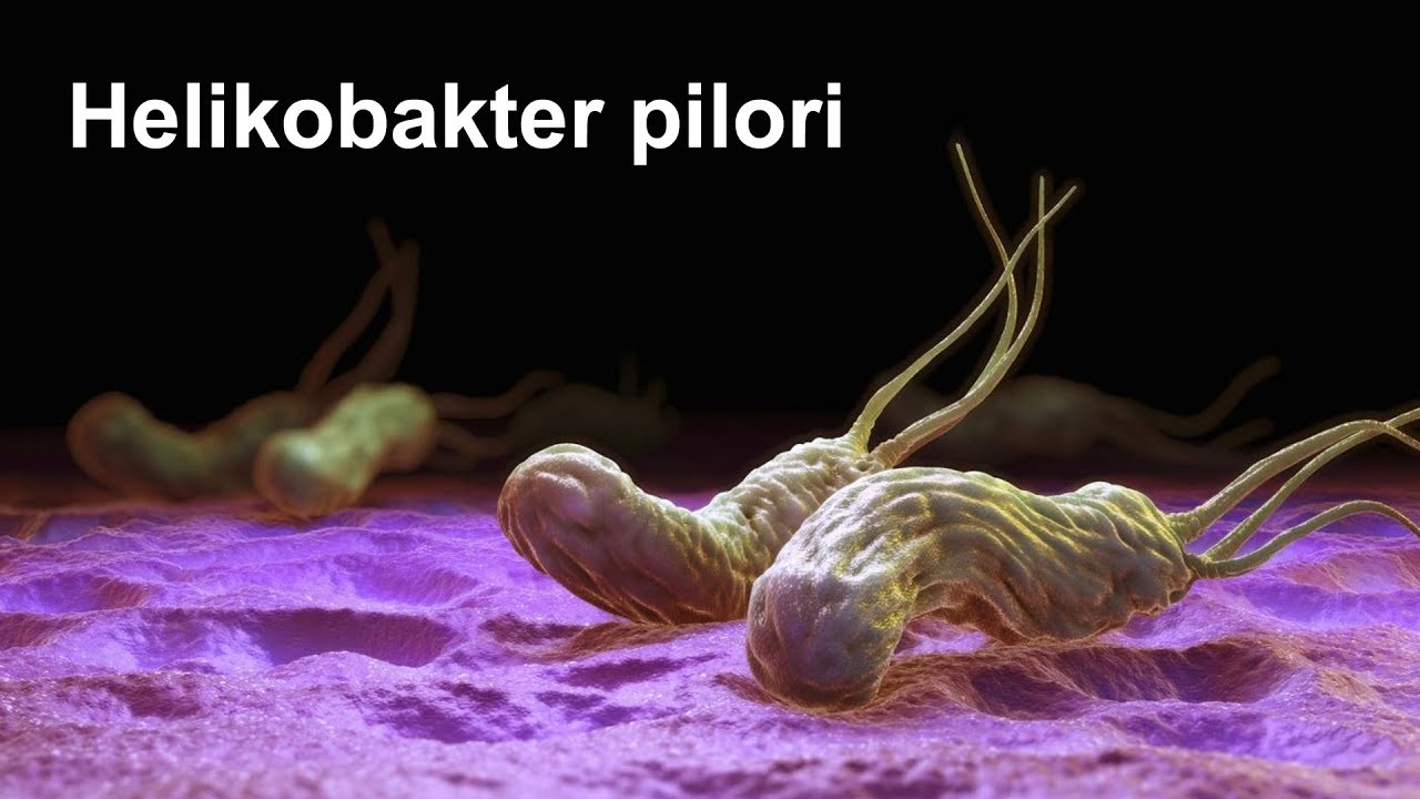 Helikobakter pilori - Hepatoloq, Qastroenteroloq Rəqsanə Cəlilova