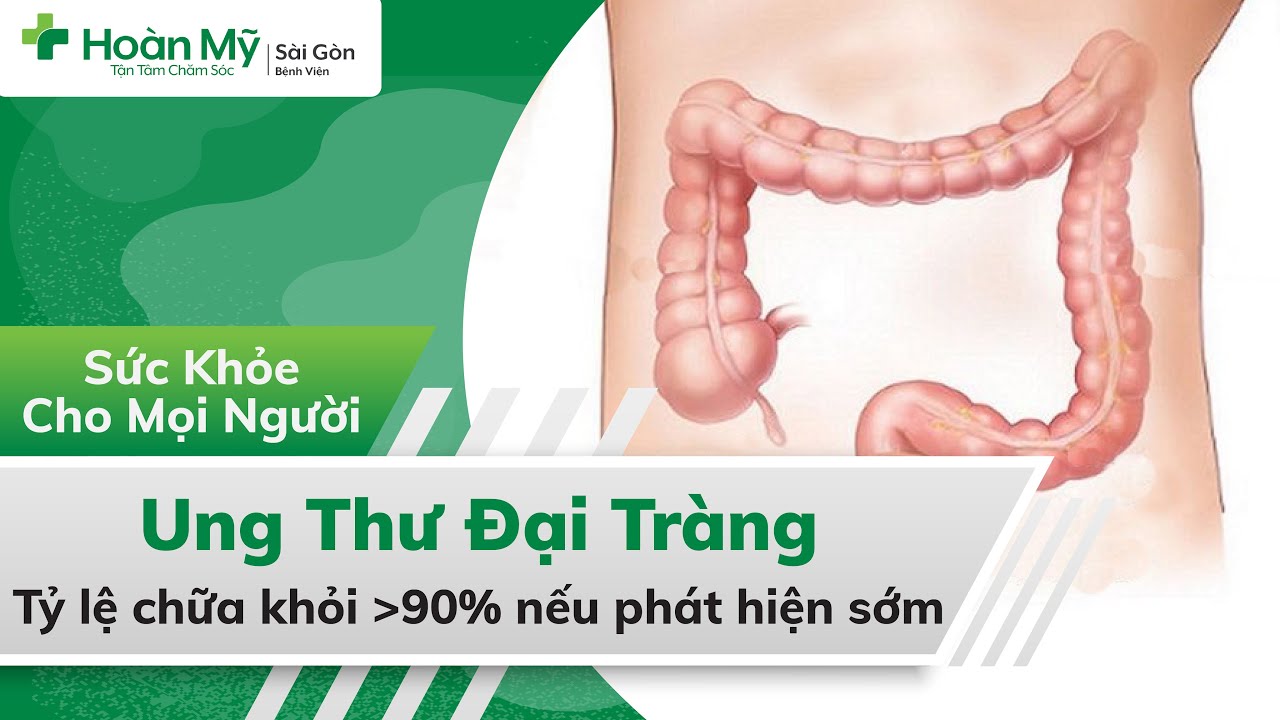 Ung thư đại tràng | Dấu hiệu phát hiện sớm, Triệu chứng, Nguyên nhân và Điều trị