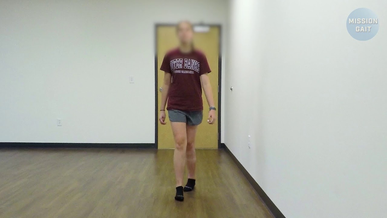 Gait Dystonia - Case Study 24 Update