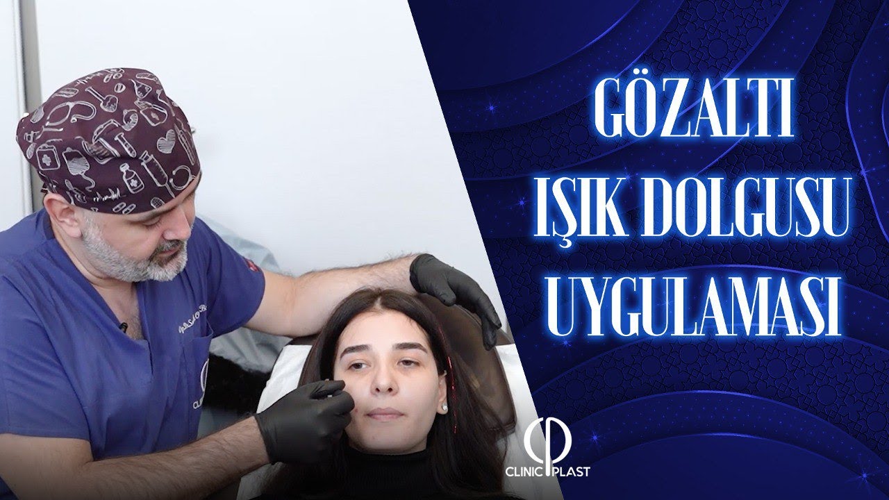 Gözaltı Işık Dolgusu Uygulaması