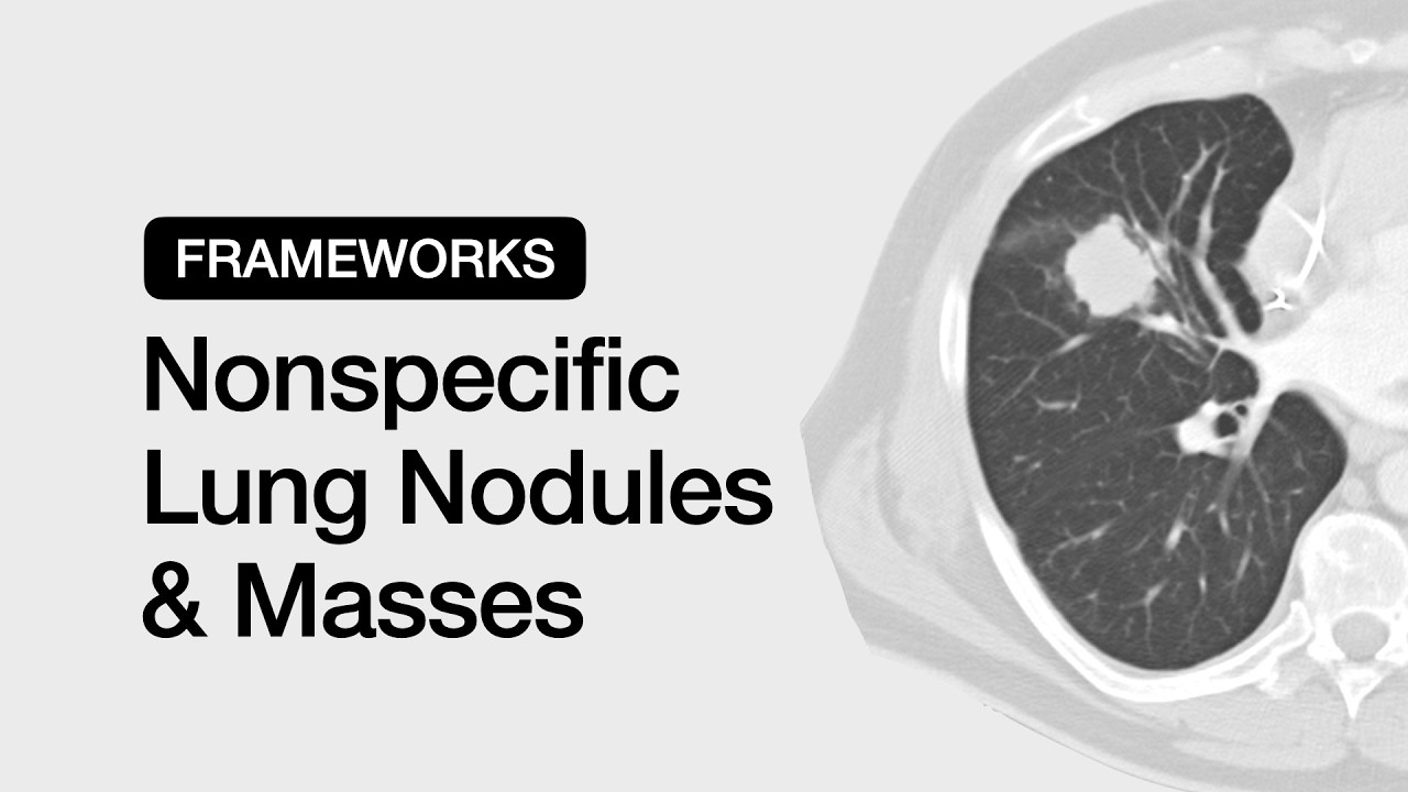Nonspecific Lung Nodules & Masses | Chest Radiology Essentials