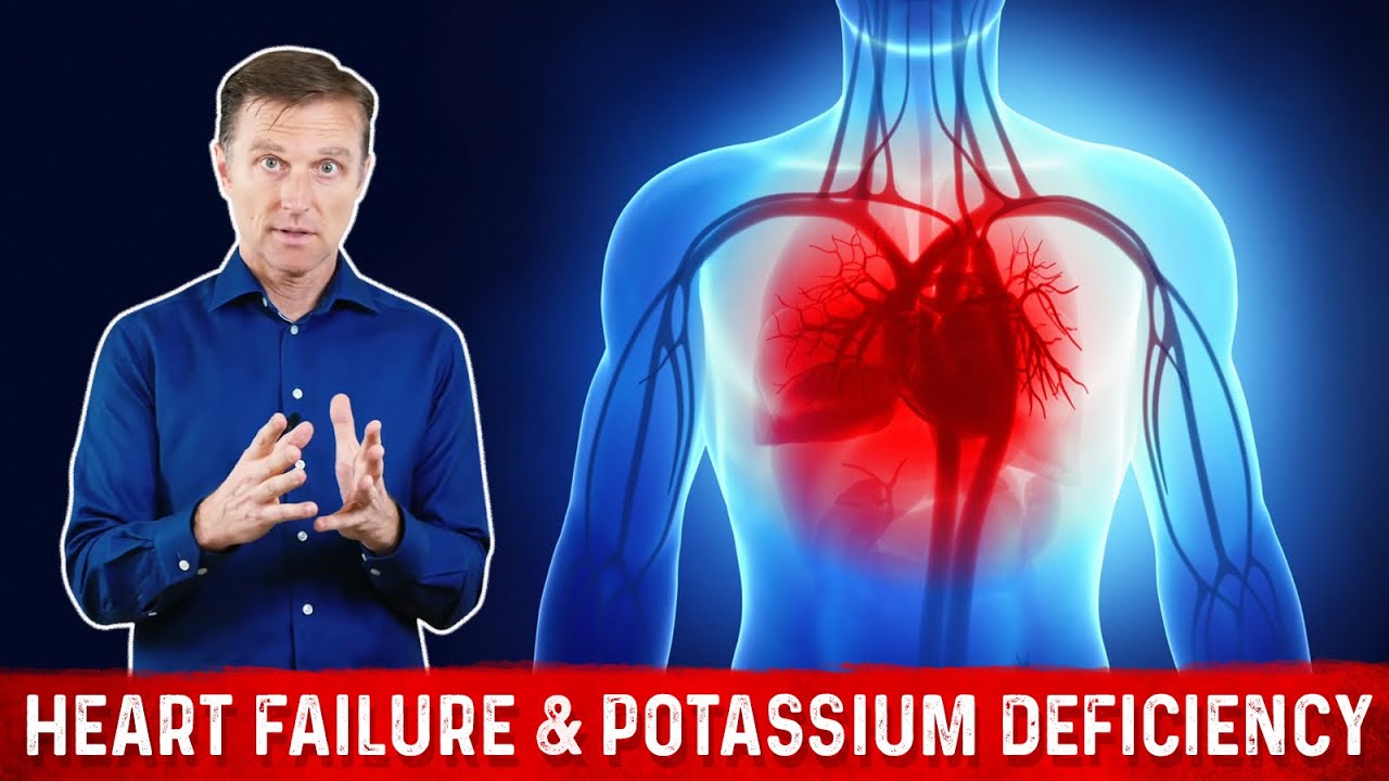 Causes & Symptoms of Potassium Deficiency &ndash; Dr. Berg