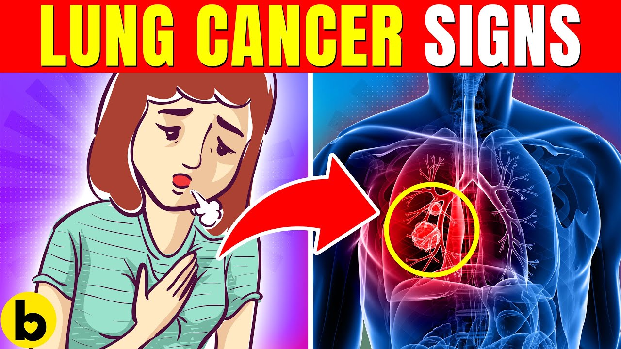 Early Warning Signs Of Lungs Cancer You Should Not Ignore