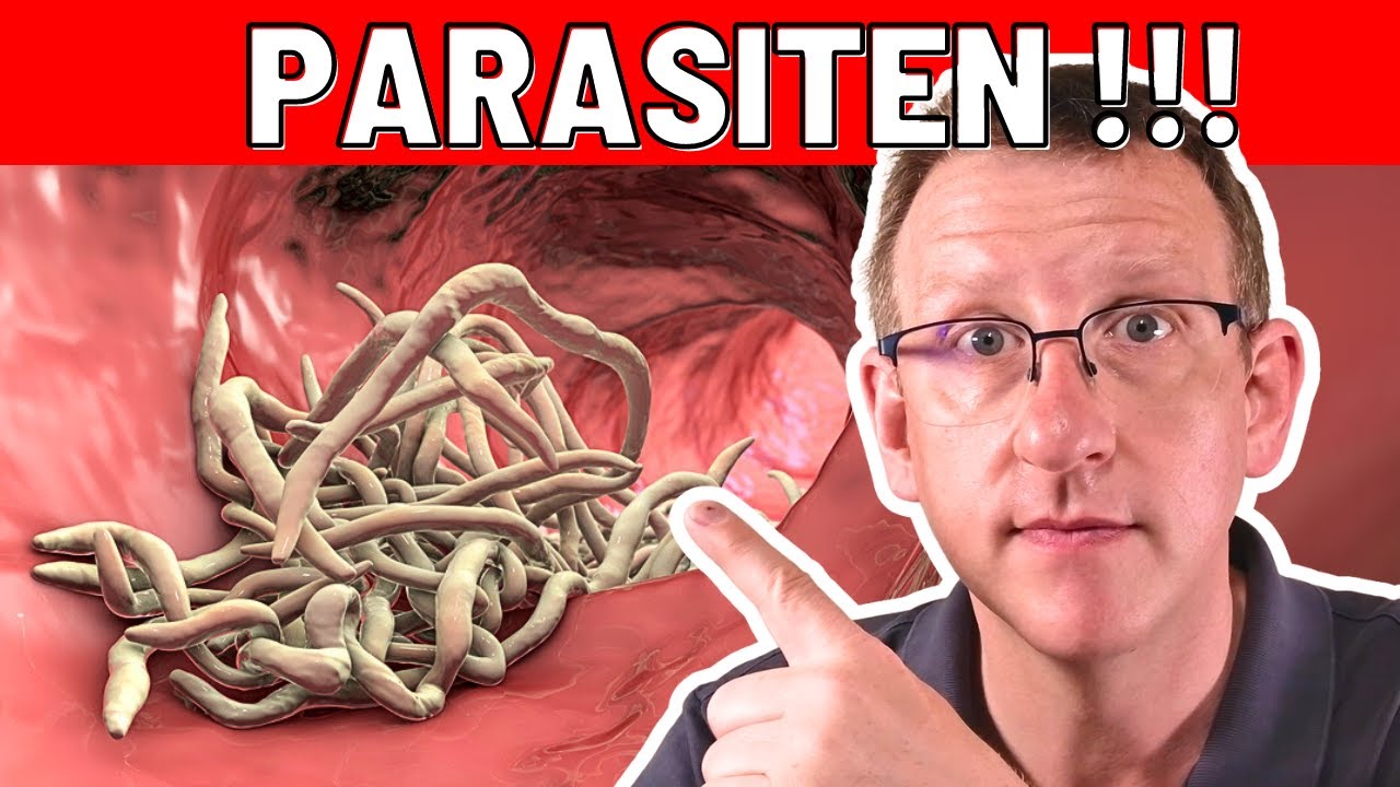 10 Frühwarnzeichen von Parasiten, die sofortiges Handeln erfordern!