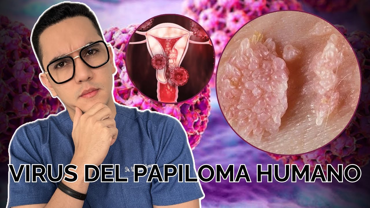 ¡Alerta! Virus del papiloma humano, una amenaza silenciosa | Dr. William Guerrero