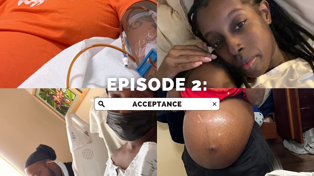 My pregnancy journey| Polyhydramnios & Hyperemesis Gravidarum: Docuseries Episode 2