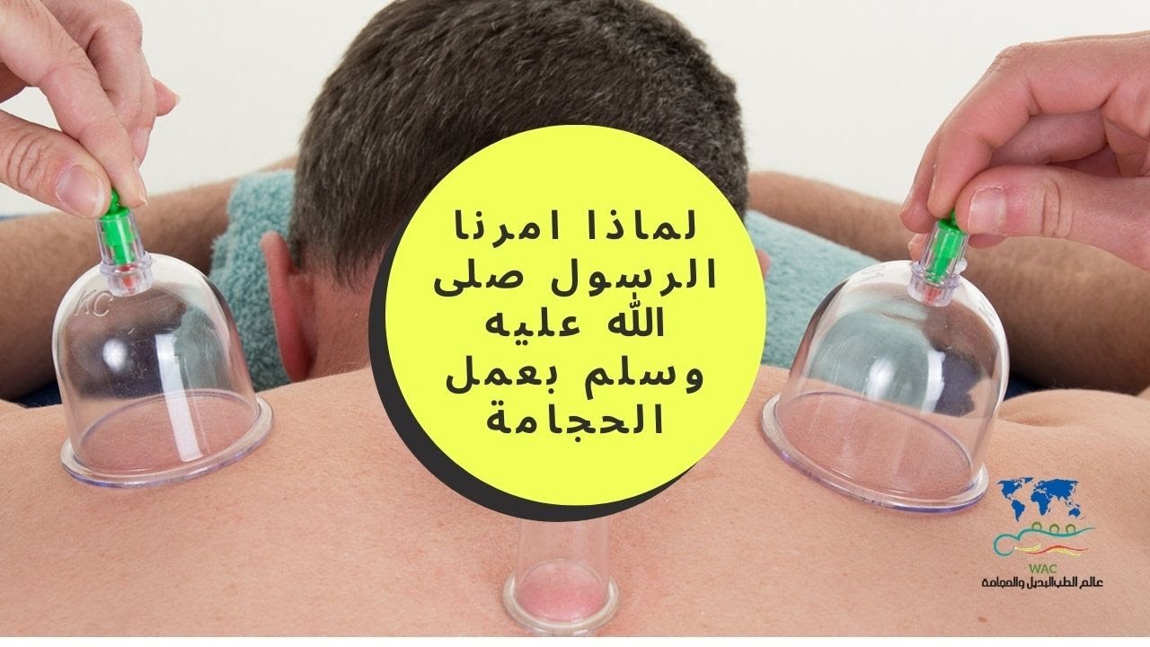 تعرف على اهم مواضع الحجامة الوقائية بالجسم