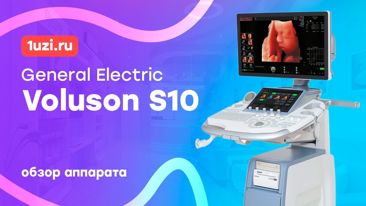 Обзор УЗИ аппарата General Electric Voluson S10
