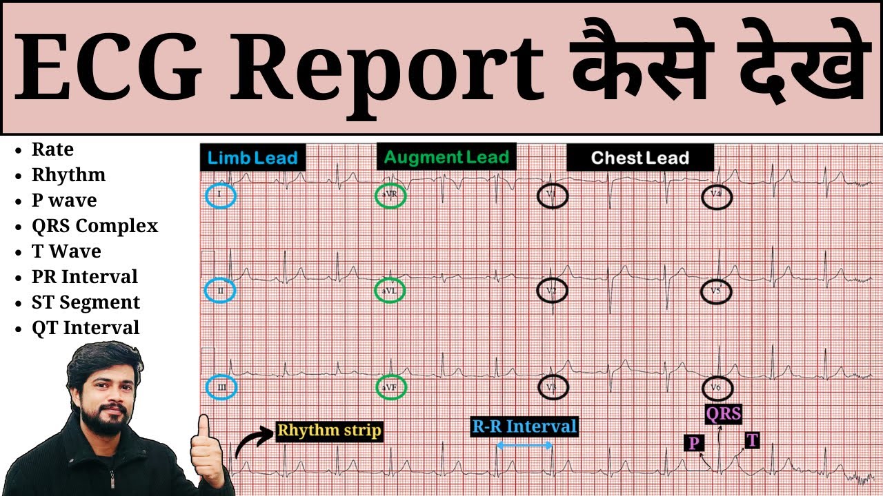 How to Read ECG | ECG Report Kaise Dekhe | ECG Report Kaise Check Kare | Normal & Abnormal